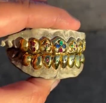 Gold full-set grillz with colored gemstones held in a hand